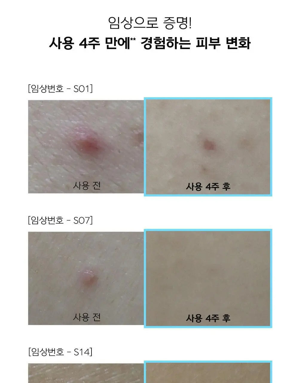 [등드름완화/체취케어] 디어도어 브레이크 PDRN 저자극 바디미스트 200ml 상세페이지 10